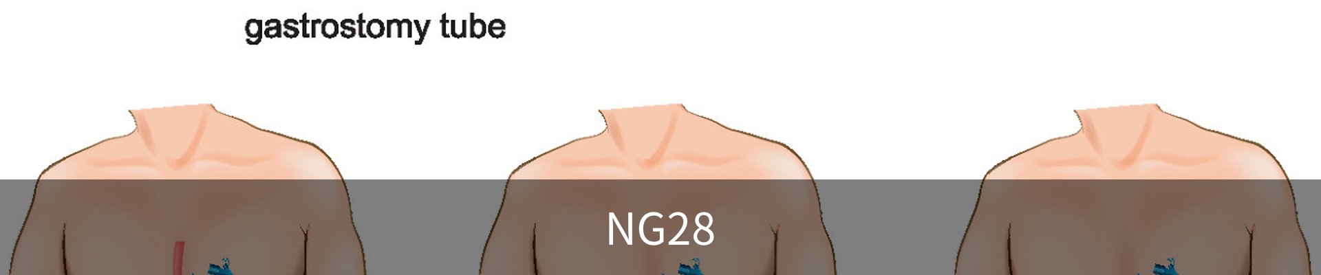 NG28